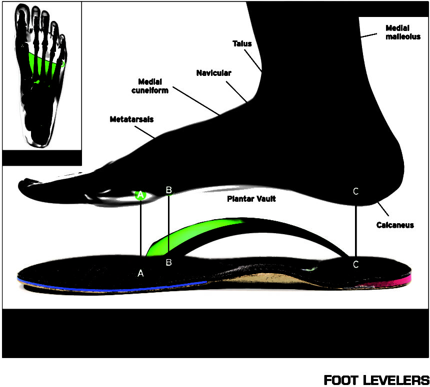 3-Arch-Difference – NBS Fitness